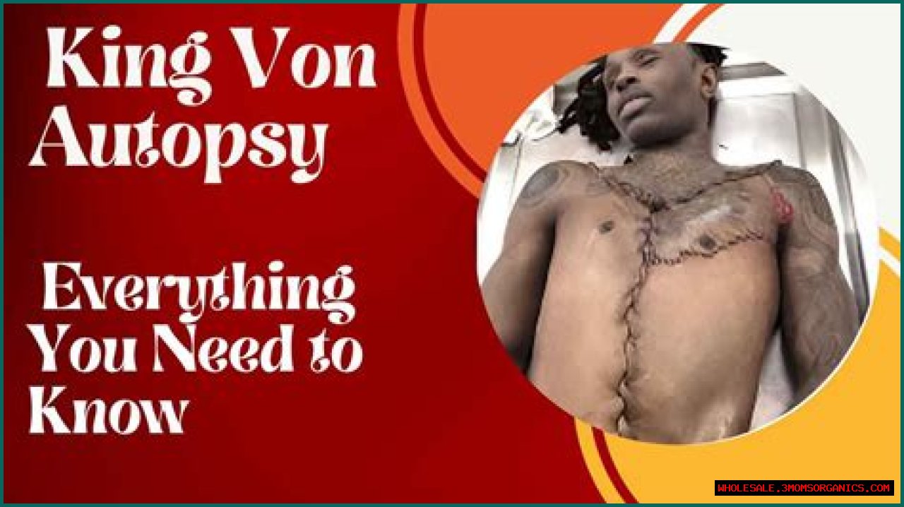 Unraveling The Mystery: King Von Body Autopsy