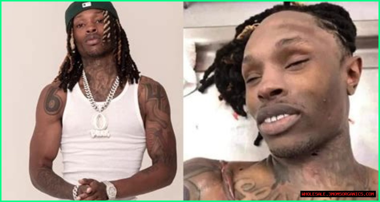 Unseen Autopsy Images Of King Von: The Tragic Aftermath Revealed