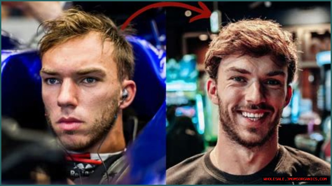 Unveiling Pierre Gasly's Hair Loss: Insights And Revelations